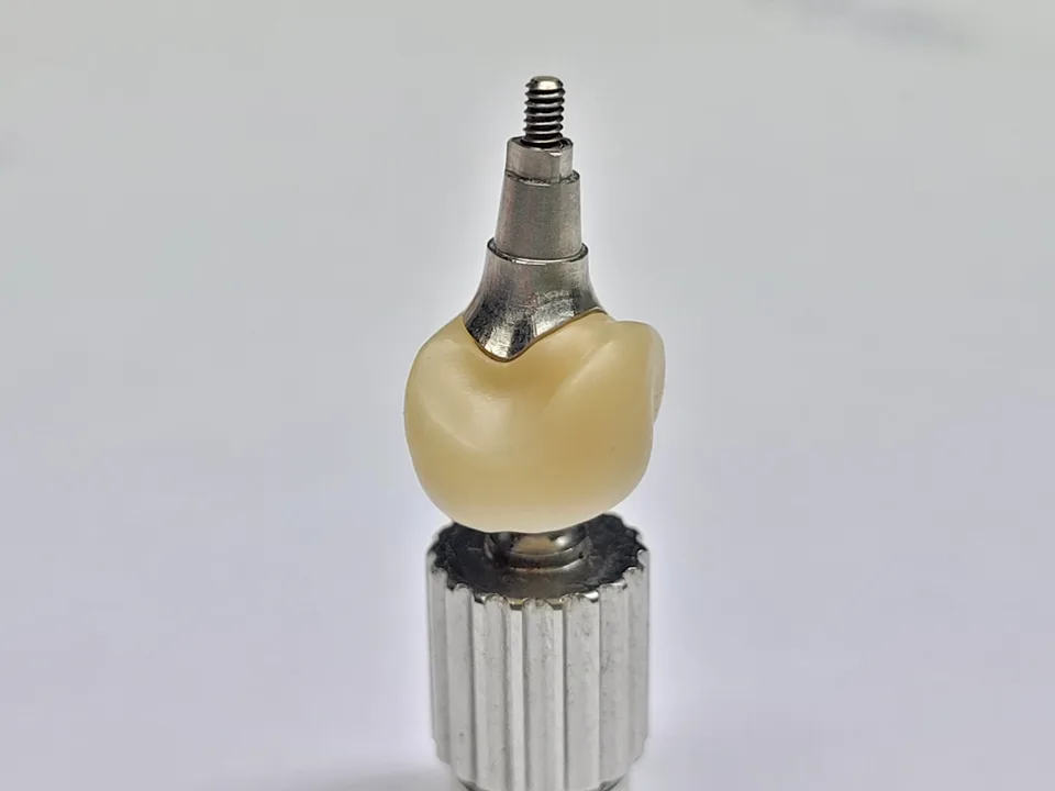 Zircone sur implant